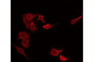 ABIN6266557 staining NIH-3T3 by IF/ICC. (HCG beta Antikörper)
