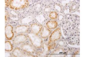 Image no. 1 for anti-ACC Synthase-Like Protein 1 (ACCS) (AA 1-101) antibody (ABIN466256) (PHACS Antikörper  (AA 1-101))