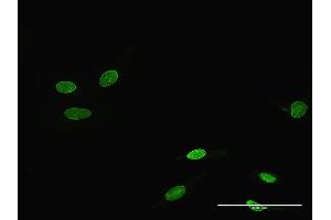 Immunofluorescence of purified MaxPab antibody to RORA on HeLa cell.