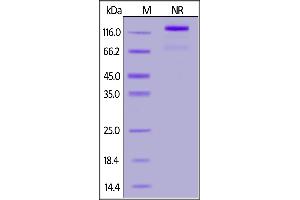 Human CD40 Ligand, Fc Tag (active trimer) (MALS verified) on  under ing (NR) condition. (CD40 Ligand Protein (CD40LG) (AA 116-261) (Fc Tag))