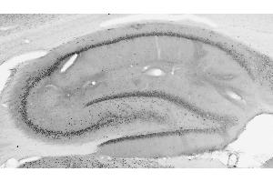 Immunoblot versus samples from adult rat brain (RBLSP) and WT and BAF53b KO mouse brains probed with N332B/15 (left) and N336B/83 (right) TC supes.