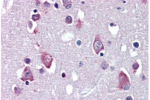 Brain, cortex, Human: Formalin-Fixed, Paraffin-Embedded (FFPE) (BDNF Antikörper  (AA 183-194))