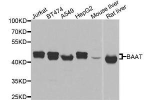 Western blot analysis of extracts of various cell lines, using BAAT antibody. (BAAT Antikörper)