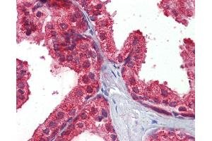 Anti-CLIP1 / CLIP170 antibody IHC of human prostate. (CLIP1 Antikörper  (AA 1404-1417))