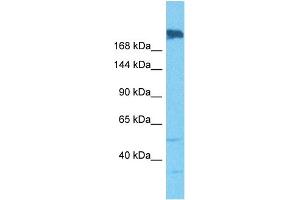 Host:  Rabbit  Target Name:  SNRNP200  Sample Tissue:  Human A549 Whole Cell  Antibody Dilution:  1ug/ml (SNRNP200 Antikörper  (N-Term))