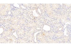 Detection of IL12B in Human Kidney Tissue using Monoclonal Antibody to Interleukin 12B (IL12B) (IL12B Antikörper  (AA 30-320))