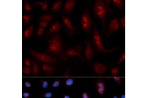 Immunofluorescence analysis of U2OS cells using PLCB1 Polyclonal Antibody