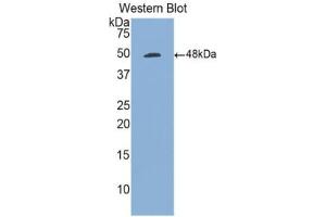 Western blot analysis of the recombinant protein. (CD70 Antikörper  (AA 47-191))