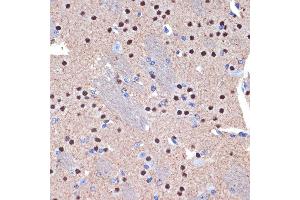 Immunohistochemistry of paraffin-embedded mouse brain using CTIP2/BCL11B Rabbit mAb (ABIN7265807) at dilution of 1:100 (40x lens). (BCL11B Antikörper)