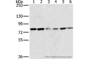 Western blot analysis of 293T and hela cell, human testis tissue, skov3, Raji and Jurkat cell, using NOX5 Polyclonal Antibody at dilution of 1:200
