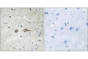 Immunohistochemistry analysis of paraffin-embedded human brain tissue, using MADD Antibody. (MADD Antikörper  (AA 751-800))