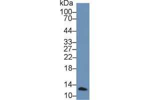Rabbit Capture antibody from the kit in WB with Positive Control: Human leukocyte lysate. (beta-2 Microglobulin CLIA Kit)