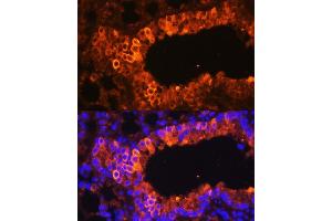 Immunofluorescence (IF) image for anti-Keratin 7 (KRT7) (AA 1-94) antibody (ABIN6143037)