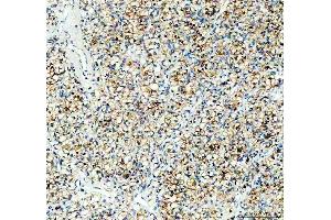 IHC analysis of PGRMC1 using anti-PGRMC1 antibody (ABIN3043899).