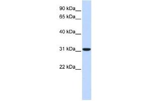 Carbonic Anhydrase VIII antibody used at 1 ug/ml to detect target protein. (CA8 Antikörper  (Middle Region))
