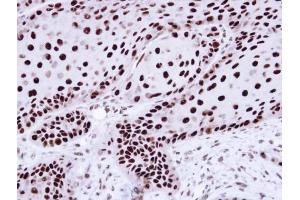 Immunohistochemistry (IHC) image for anti-Heterogeneous Nuclear Ribonucleoprotein C (C1/C2) (HNRNPC) antibody (ABIN2856905)