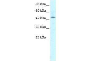 WB Suggested Anti-IRX2 Antibody Titration:  1. (IRX2 Antikörper  (Middle Region))