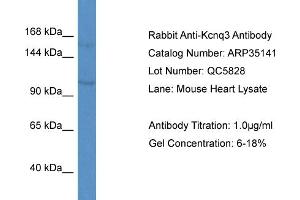 WB Suggested Anti-Kcnq3 Antibody   Titration: 1. (KCNQ3 Antikörper  (Middle Region))
