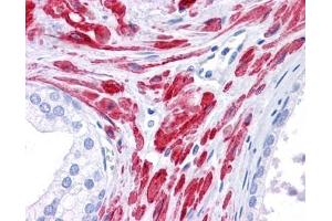 Stat5b antibody was used for immunohistochemistry at a concentration of 4-8 ug/ml. (STAT5B Antikörper  (C-Term))