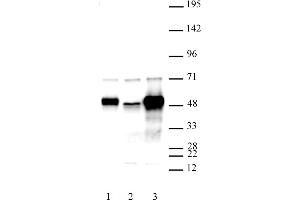 C17orf96 antibody (pAb) tested by Western blot. (C17ORF96 Antikörper  (AA 59-229))