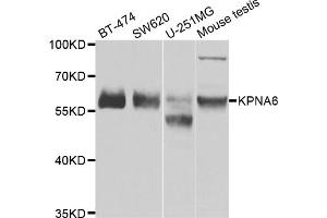 Western blot analysis of extracts of various cell lines, using KPNA6 antibody (ABIN4904176) at 1:1000 dilution. (KPNA6 Antikörper)