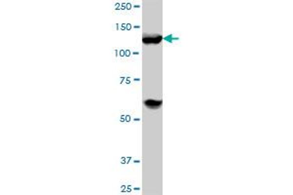 HDAC4 antibody  (AA 551-648)