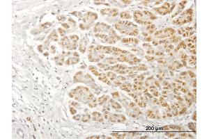 Immunostaining (ISt) image for anti-NADH Dehydrogenase (Ubiquinone) 1 alpha Subcomplex, 13 (NDUFA13) (AA 1-144) antibody (ABIN526435)