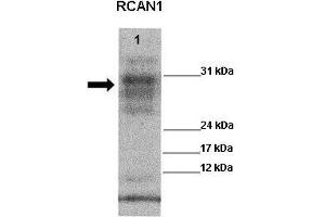 Western Blotting (WB) image for anti-Regulator of Calcineurin 1 (RCAN1) (Middle Region) antibody (ABIN2780590)