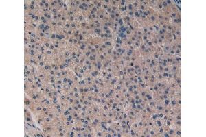 Immunohistochemistry (IHC) image for anti-Matrix Metallopeptidase 3 (Stromelysin 1, Progelatinase) (MMP3) (AA 363-477) antibody (ABIN1980457)