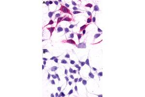 Immunocytochemistry (ICC) staining of HEK293 human embryonic kidney cells transfected (A) or untransfected (B) with GRM3. (Metabotropic Glutamate Receptor 3 Antikörper  (Extracellular Domain))