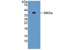Detection of Recombinant DEFb2, Mouse using Polyclonal Antibody to Defensin Beta 2 (DEFb2) (beta 2 Defensin Antikörper  (AA 21-71))