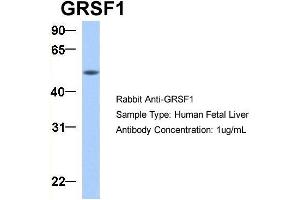 Western Blotting (WB) image for anti-G-Rich RNA Sequence Binding Factor 1 (GRSF1) (Middle Region) antibody (ABIN2778788)