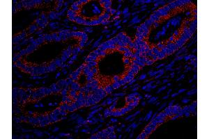 Immunofluorescence (IF) image for anti-MAP-Kinase Activating Death Domain (MADD) (AA 1597-1647) antibody (ABIN7448984) (MADD Antikörper  (AA 1597-1647))