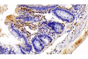Immunohistochemistry (IHC) image for anti-Ionized Calcium-binding Adapter Molecule 1 (IBA1) (AA 1-147) antibody (ABIN7437545)