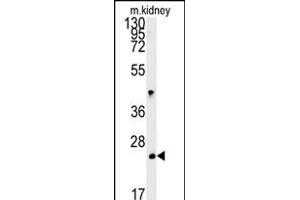 LHPL3 Antibody (C-term) (ABIN651908 and ABIN2840448) western blot analysis in mouse kidney tissue lysates (15 μg/lane). (LHFPL3 Antikörper  (C-Term))