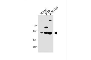 All lanes : Anti-M1 Antibody (Center) at 1:1000 dilution Lane 1: Human brain lysate Lane 2: PC-3 whole cell lysate Lane 3: U-251 MG whole cell lysate Lysates/proteins at 20 μg per lane. (AP1M1 Antikörper  (AA 205-234))