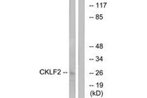 Western Blotting (WB) image for anti-CKLF-Like MARVEL Transmembrane Domain Containing 2 (CMTM2) (AA 171-220) antibody (ABIN2890220) (CMTM2 Antikörper  (AA 171-220))