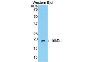 Western Blotting (WB) image for anti-Angiopoietin 1 (ANGPT1) (AA 304-450) antibody (ABIN1857992) (Angiopoietin 1 Antikörper  (AA 304-450))