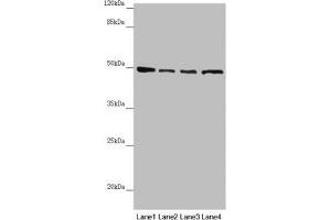 Western blot All lanes: AP1M1 antibody at 1. (AP1M1 Antikörper  (AA 1-160))
