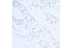 Immunohistochemistry (IHC) image for anti-Ubiquitin Protein Ligase E3 Component N-Recognin 5 (UBR5) (AA 600-650) antibody (ABIN7454646) (UBR5 Antikörper  (AA 600-650))