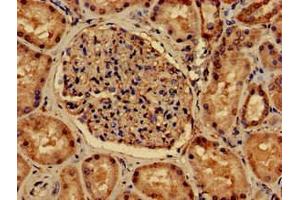 Immunohistochemistry of paraffin-embedded human kidney tissue using ABIN7162722 at dilution of 1:100 (PDLIM2 Antikörper  (AA 161-284))