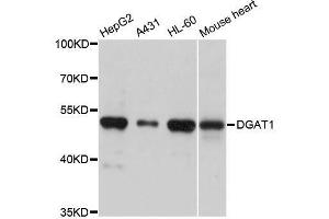 Western blot analysis of extracts of various cell lines, using DGAT1 antibody. (DGAT1 Antikörper  (AA 200-300))