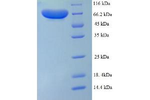SDS-PAGE (SDS) image for Peptidyl Arginine Deiminase, Type I (PADI1) (AA 1-663), (full length) protein (His tag) (ABIN5711951)