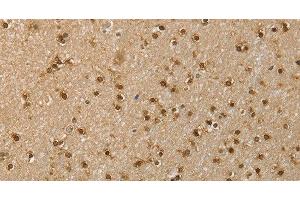 Immunohistochemistry of paraffin-embedded Human brain using RNH1 Polyclonal Antibody at dilution of 1:40 (RNH1 Antikörper)