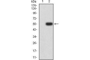 Western blot analysis using CD119 mAb against HEK293 (1) and CD119 (AA: extra 18-245)-hIgGFc transfected HEK293 (2) cell lysate.
