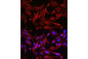 Immunofluorescence analysis of U2OS cells using ST Rabbit pAb (ABIN6128541, ABIN6148581, ABIN6148582 and ABIN6213980) at dilution of 1:200 (40x lens). (STAT6 Antikörper  (AA 1-180))