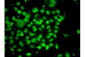 Immunofluorescence analysis of A-549 cells using SMYD3 antibody (ABIN6128709, ABIN6148169, ABIN6148170 and ABIN6223146). (SMYD3 Antikörper  (AA 140-369))