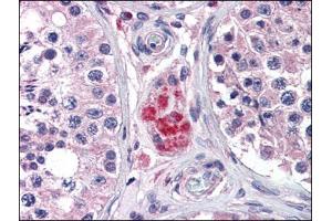 Immunohistochemistry Image: Human Testis: Formalin-Fixed, Paraffin-Embedded (FFPE) (PPARD Antikörper  (C-Term))