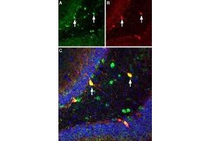 Multiplex staining of ASIC1 and parvalbumin in rat hippocampusImmunohistochemical staining of immersion-fixed, free floating rat brain frozen sections using Guinea pig Anti-ASIC1 Antibody (ABIN7042914, ABIN7045410 and ABIN7045411), (1:300).