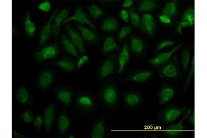 Immunofluorescence of monoclonal antibody to FH on HeLa cell. (FH Antikörper  (AA 33-510))